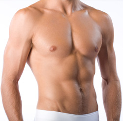 gynecomastia